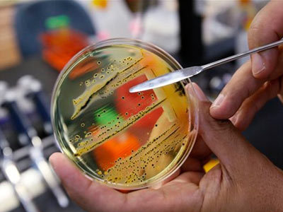 bacteria-petri-dish